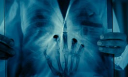 Интерны 113 серия Интерны 113 серия